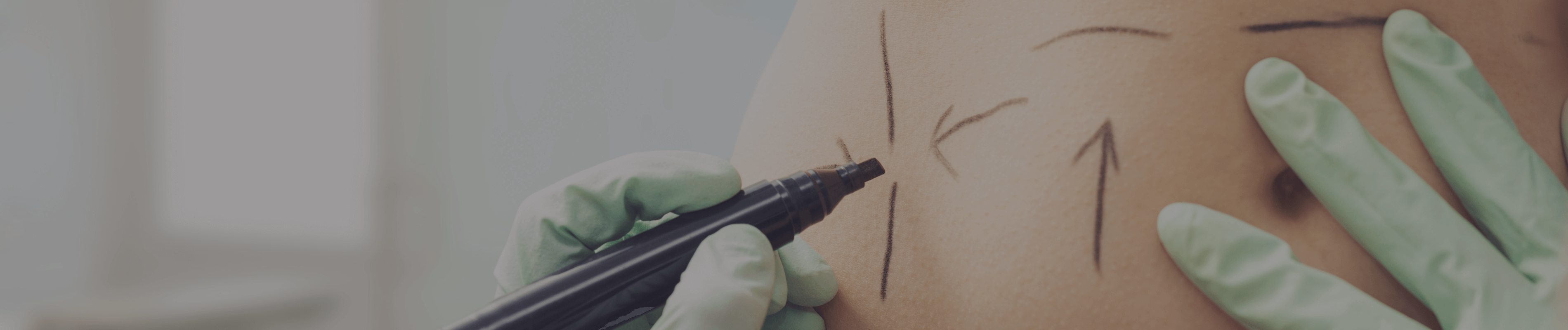 Labioplastik — Intimästhetik für Frauen in der EsteGo Clinic Istanbul