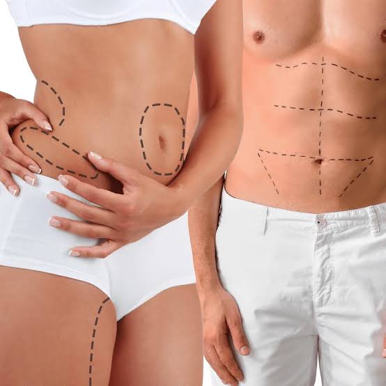 oberarmstraffung lipo